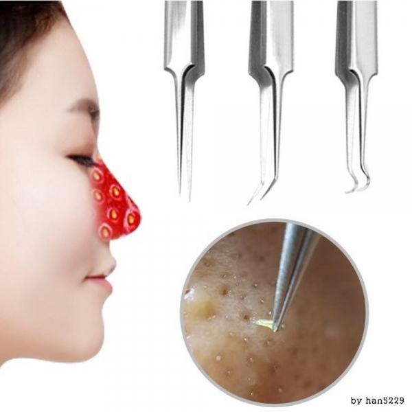 피지제거기 짜기 코 얼굴 블랙헤드 압출 바늘