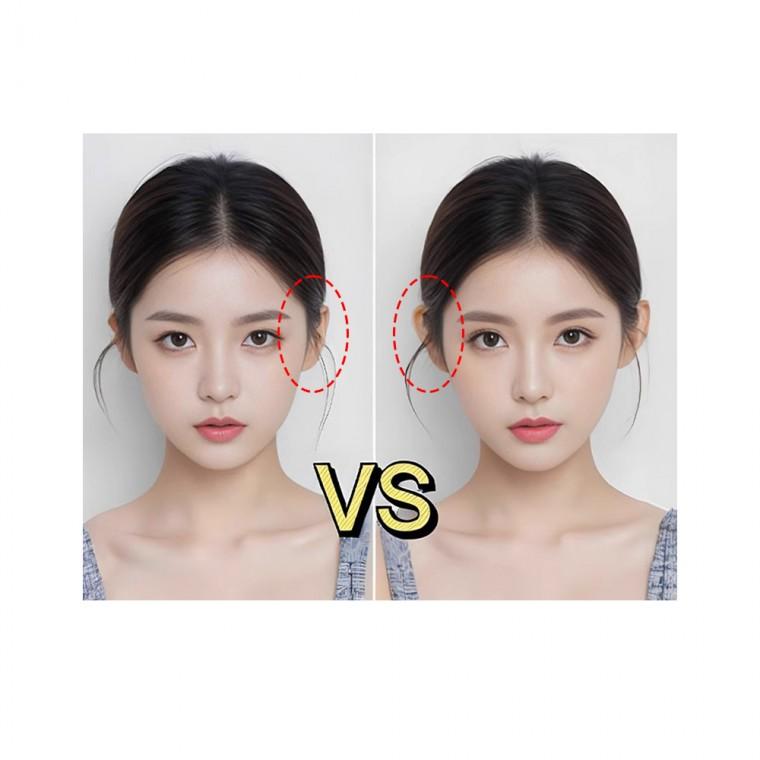 누운귀 테이프 요정귀테이프 귀 성형 리프팅 스티커 얼굴 교정 테이프