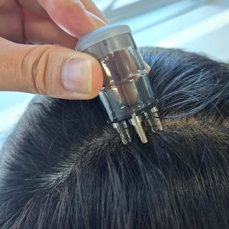 휴대용 두피 마사지 앰플 도포기 5ml