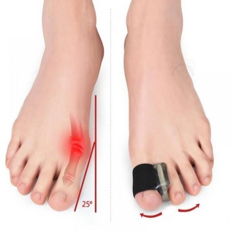 외반 엄지발가락 밴드