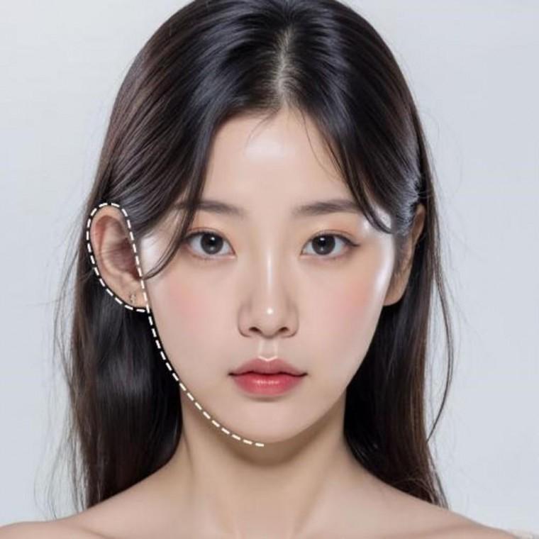 요정귀 테이프 귀필러 스티커 얼굴작아보이기 소두 미용 리프팅패치