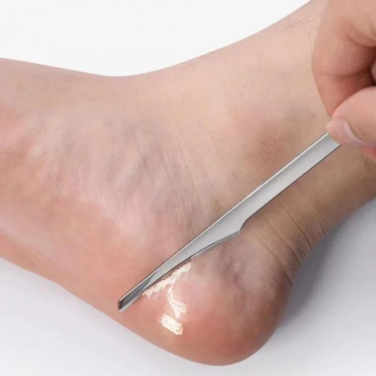 사이노텍 굳은살제거기 스크래퍼 발각질제거 손 발 굳은살 각질 풋