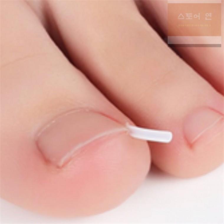 연은마트 내성발톱받침대 10개입 내성발톱관리 교정